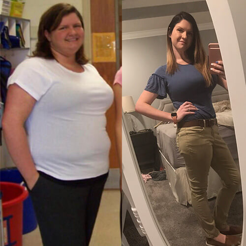 Before and after photos of Rachel